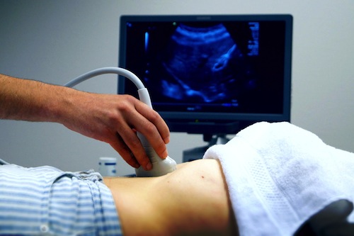 Cost of Ultrasound Scan in Nigeria nigeriantech.com.ng