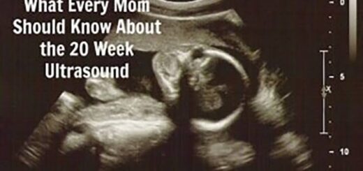How to Prepare for 20 week ultrasound in Nigeria Nigeriantech.com.ng