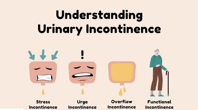 Types of Urinary incontinence in Nigeria Nigeriantech.com.ng
